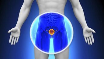 Behandlung von Prostatitis mit Medikamenten