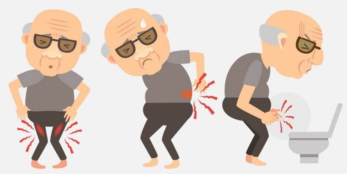 Symptome einer Prostatitis