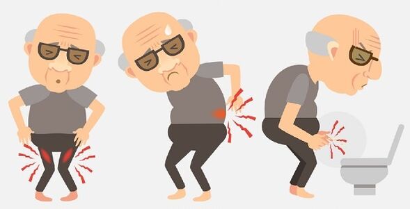 Symptome einer Prostatitis und ihre Behandlung mit Medikamenten